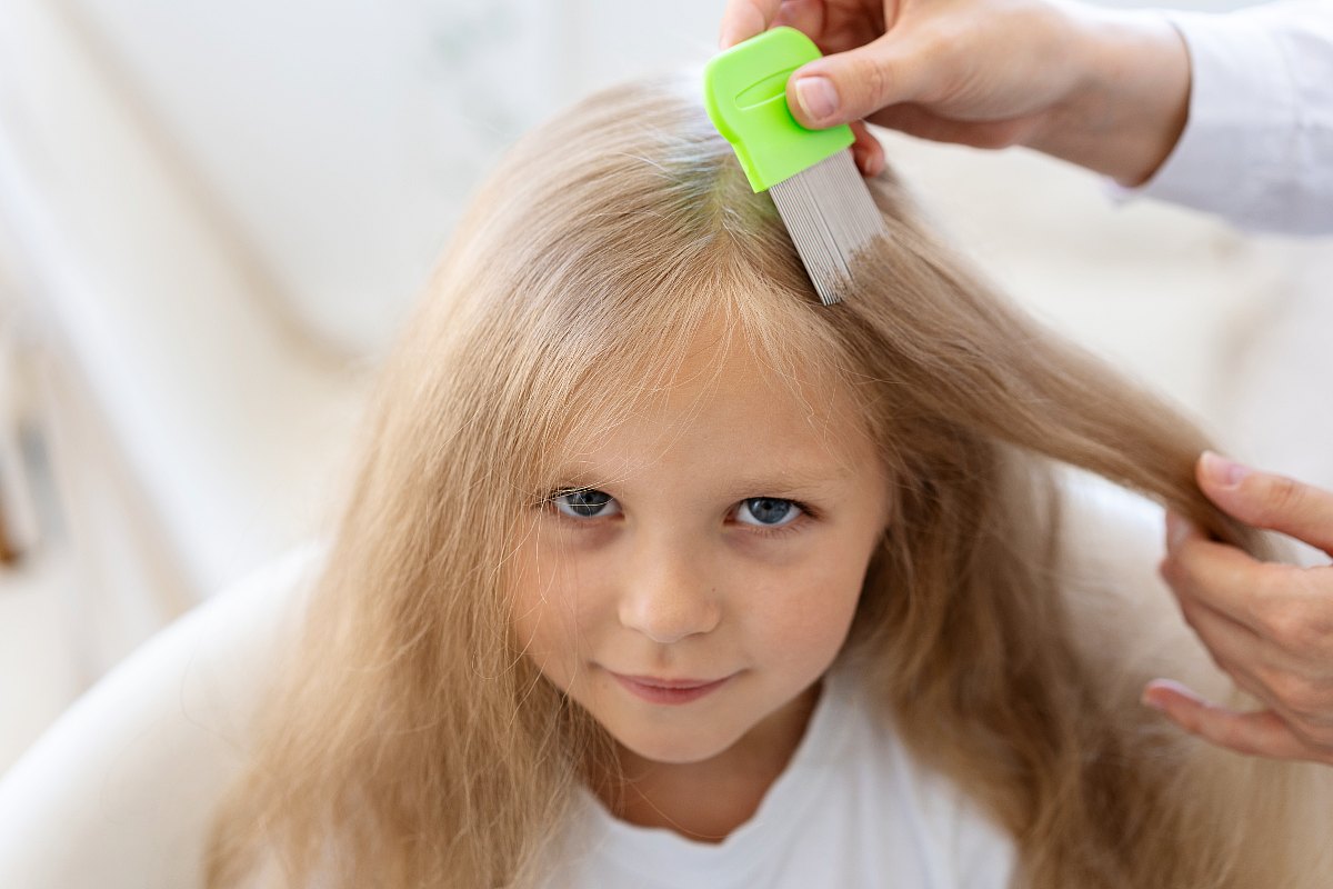 Τι είναι οι ψείρες: Μετάδοση, καταπολέμηση και πρόληψη