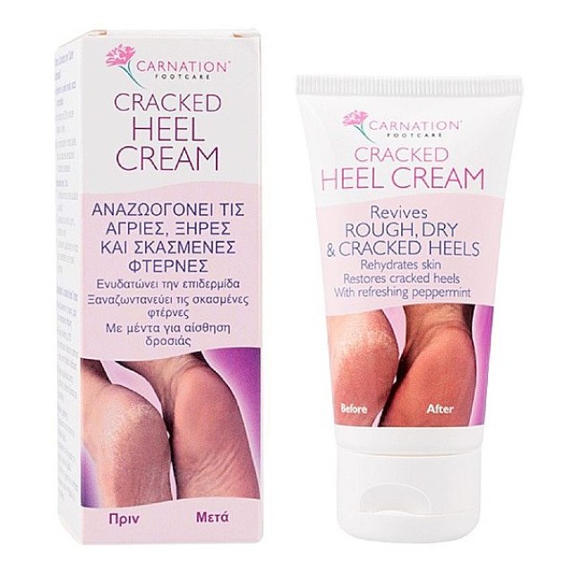 Carnation Cracked Heel Cream 50ml